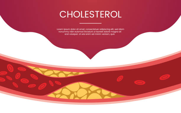 ilustrações, clipart, desenhos animados e ícones de tema humano do conceito da veia do colesterol para a bandeira do molde ou homepage da aterragem infográficos-vetor - colesterol
