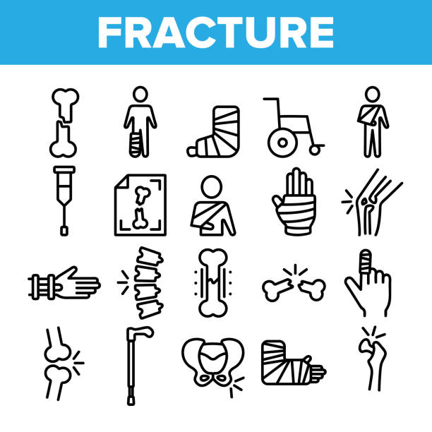 Collection Fracture Elements Vector Sign Icons Set Collection Fracture Elements Vector Sign Icons Set Thin Line. Gypsum Foot And Hand Arm Crutch, Bones Fracture Linear Pictograms. Medicine Details And Character Monochrome Contour Illustrations bone fracture stock illustrations