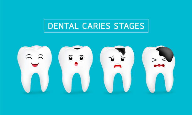Cute cartoon tooth character show stages of caries development. Dental care concept, illustration isolated on blue background. dental cavity stock illustrations