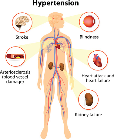 damage from high blood pressure