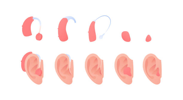 청각 장애인과 원조 개념을 들을 수 있습니다. 벡터 플랫 일러스트 세트입니다. 흰색에 고립 된 인간의 귀에 삽입 보청기 장치의 컬렉션. 의학, 건강 관리를위한 설계 요소. - hearing aid stock illustrations