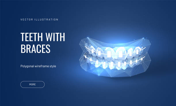 歯科ブレースは未来的な多角形の様式のイラストをベクトルする。咬傷改善のための歯科矯正治療 - 矯正歯科医点のイラスト素材／クリップアート素材／マンガ素材／アイコン素材