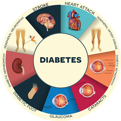 Modeling long-term diabetes and related complications in rats