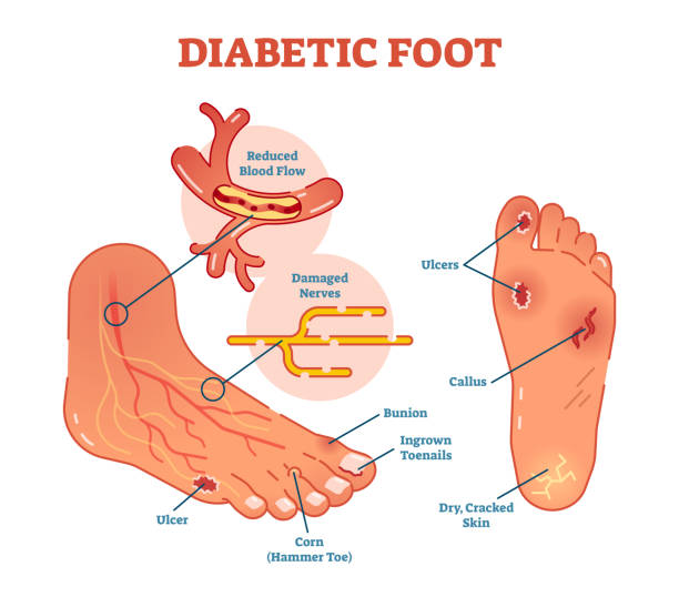 diabetic foot examination)