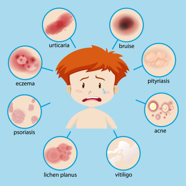 Diagram showing boy with different skin conditions illustration