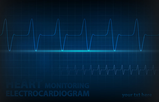 ecg heart monitoring - medical background