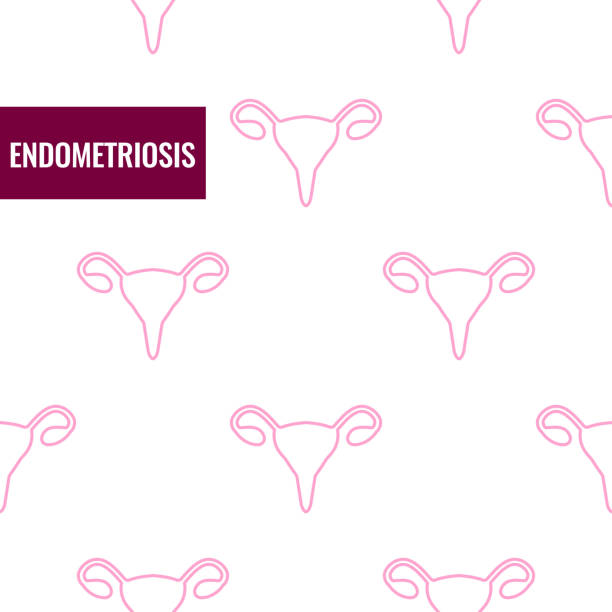 illustrations, cliparts, dessins animés et icônes de affiche médicale de sensibilisation à l’endométriose dans le style linéaire - endométriose