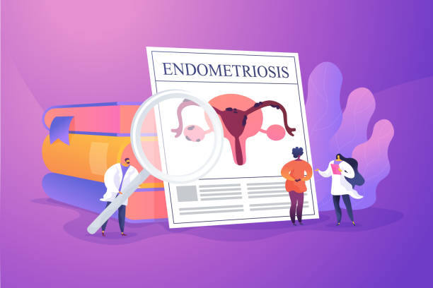 illustrations, cliparts, dessins animés et icônes de illustration de vecteur de concept d'endométriose - endométriose