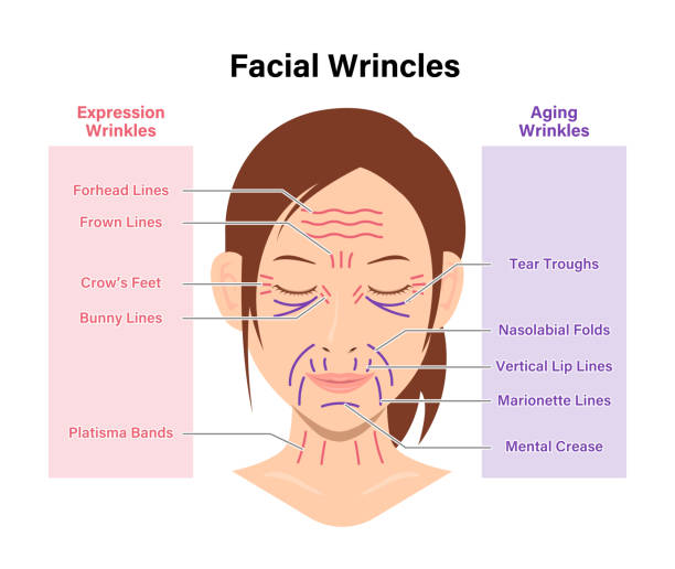 Expression wrinkles and Aging wrinkles ( female face ) vector illustration Expression wrinkles and Aging wrinkles ( female face ) vector illustration cartoon of a wrinkled old lady stock illustrations