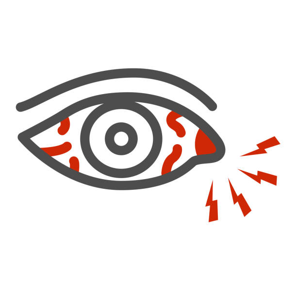 Eye pain and infection line icon, illness and injury concept, Sore eyes sign on white background, Redness of eyes icon in outline style for mobile concept and web design. Vector graphics. Eye pain and infection line icon, illness and injury concept, Sore eyes sign on white background, Redness of eyes icon in outline style for mobile concept and web design. Vector graphics pain designs stock illustrations
