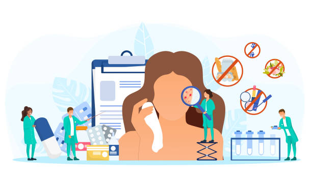 Female face with allergies and acne Female face with allergies and acne. Concept of allergology disease and medical treatment. Doctors examining red spots, giving prescription, making list of forbidden food. Flat vector illustration antihistamine stock illustrations