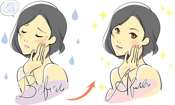 Female skin care Women who suffer from rough skin and skin care stained illustrations stock illustrations