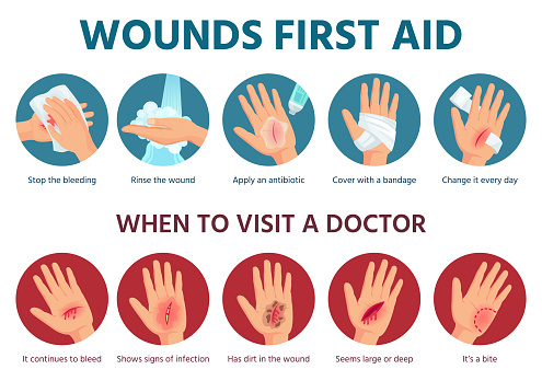 First aid for wound on skin. Treatment procedure for bleeding cut. Bandage on injured palm. Emergency situation safety infographic in vector