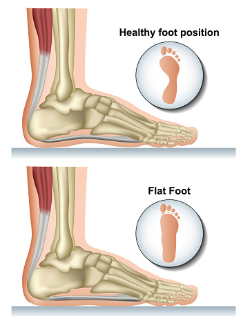 Flat foot medical vector illustration on white background