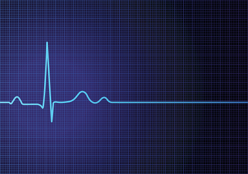 Vector illustration of EKG screen with a flatline heart rate.