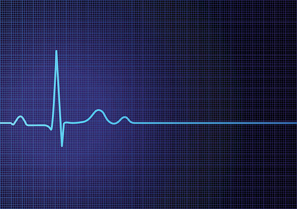 Flat line EKG Vector illustration of EKG screen with a flatline heart rate. listening to heartbeat stock illustrations