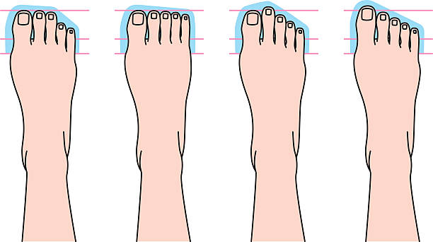 Form of toes Form of toes human toe stock illustrations