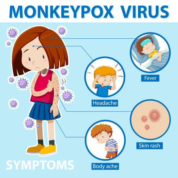 ilustraciones, imágenes clip art, dibujos animados e iconos de stock de una niña con viruela del mono y los síntomas - monkey pox