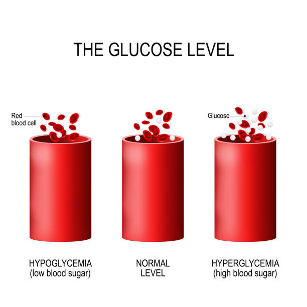 Glucose in the blood vessel. Glucose in the blood vessel. normal level, hyperglycemia (high blood sugar), hypoglycemia (low blood sugar). Vector diagram for your design, educational, science and medical use hyperglycemia stock illustrations