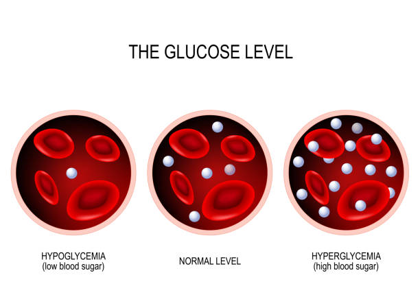 Glucose in the blood vessel. Glucose in the blood vessel. normal level, hyperglycemia (high blood sugar), hypoglycemia (low blood sugar). vector diagram hyperglycemia stock illustrations