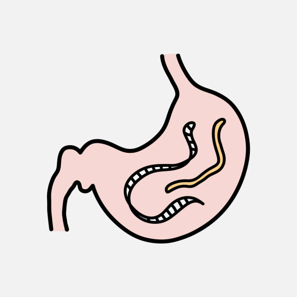 Gut parasites doodle, hand drawn vector doodle illustration of worm parasites inside the stomach, isolated on white background. Gut parasites doodle, hand drawn vector doodle illustration of worm parasites inside the stomach, isolated on white background. pics of a tapeworm in humans stock illustrations
