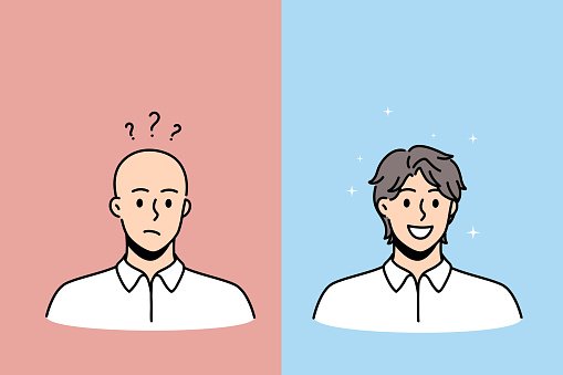 Hair loss and baldness concept
