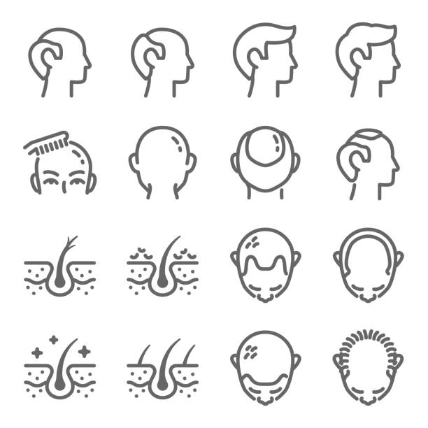 stockillustraties, clipart, cartoons en iconen met het illustreren van het haarpictogramdector van de vector. bevat pictogrammen zoals alopecia, kaal, kaalheid, haar, haarloos, verlies, hoofdhuid, en meer. uitgevouwen lijn - haaruitval