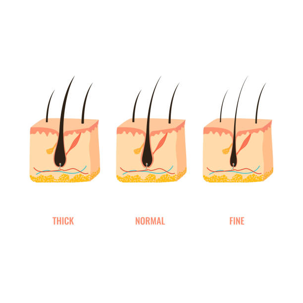 Hair width structure in skin cross-section diagram Hair thickness types classification set. Skin cross-section with fine, normal, thick strands. Anatomical structure scheme. Cartoon vector illustration. hair thickness chart stock illustrations