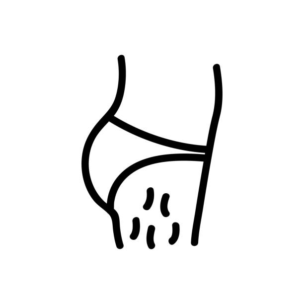 2,313 Cellulite Illustrations & Clip Art - iStock