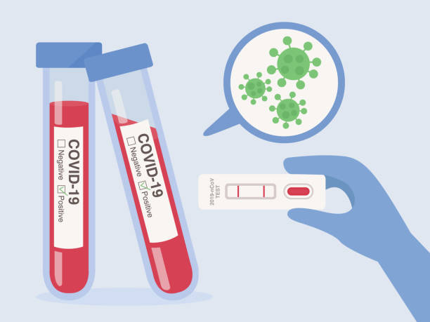 유리 관에 환자 혈액 샘플을 가진 바이러스 성 질환 covid-19에 대한 테스트 키트를 들고 의사의 손. 라벨에 대한 테스트 결과는 양수입니다. - pcr 장치 stock illustrations