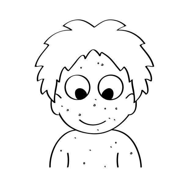 ilustrações de stock, clip art, desenhos animados e ícones de happy sick child with skin rash, chicken pox disease. cartoon outline vector - varíola