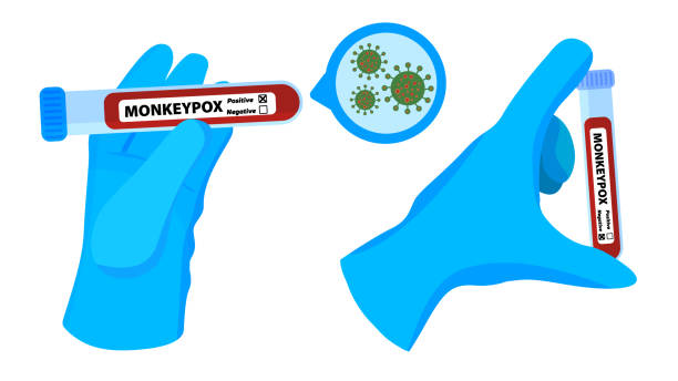 health worker, hand in medical gloves, sample test tube with blood diagnosed positive, negative for monkeypox 2022 virus close up bacteria cell. testing for monkey pox. medicine concept vector - monkey pox stock illustrations