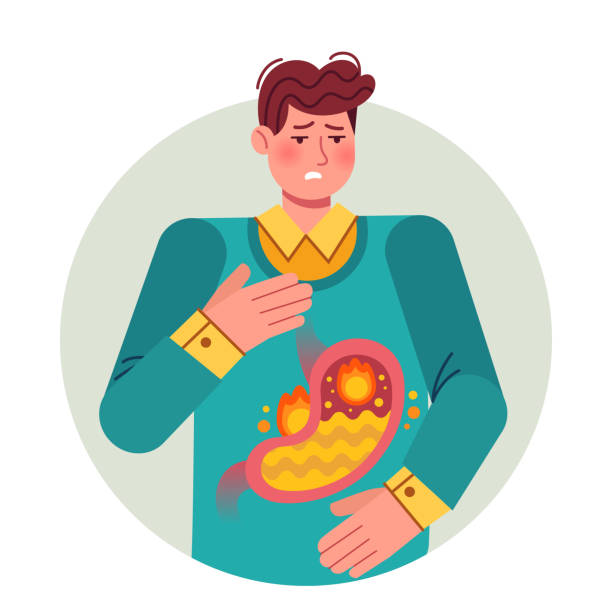 Heartburn. Gastric disease, stomach problem. Bloating abdomen gastroesophageal reflux or high acidity esophagus, flat vector illustration. Heartburn. Gastric disease, stomach problem. Ill cartoon man having disease, feeling pain bloating abdomen gastroesophageal reflux or high acidity esophagus, flat vector illustration. acidity stock illustrations