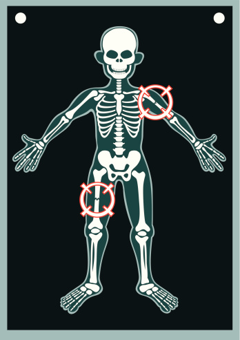Human Body X Ray