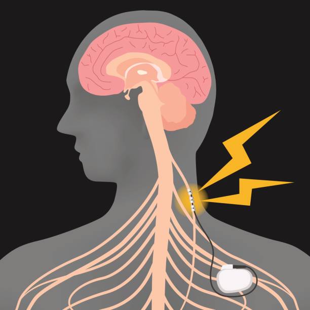 human brain and vagus nerve stimulation:VNS, image illustration human brain and vagus nerve stimulation:VNS, image illustration vagus nerve stock illustrations