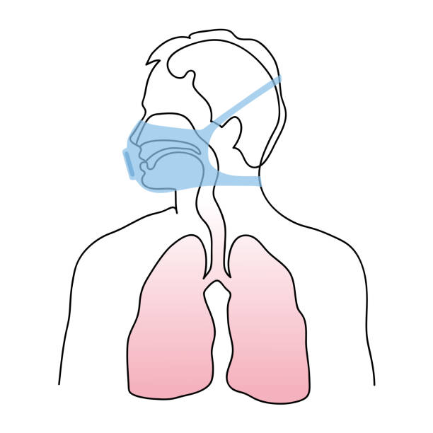 Laryngeal Mask Illustrations, Royalty-Free Vector Graphics & Clip Art ...