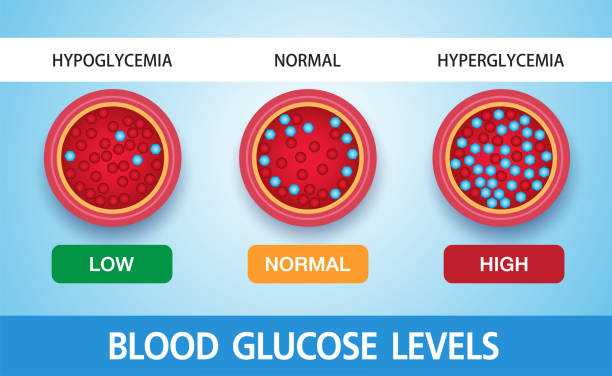 Hyperglycemia, High Blood Sugar and Diabetes ,obesity is a serious medical condition causes, vector design. Hyperglycemia, High Blood Sugar and Diabetes ,obesity is a serious medical condition causes, vector design. hyperglycemia stock illustrations