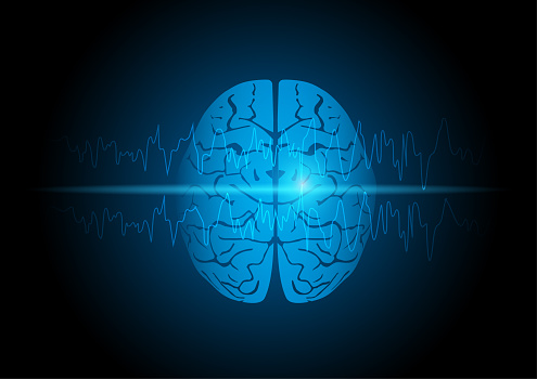 Illustration of focal seizure and human brain