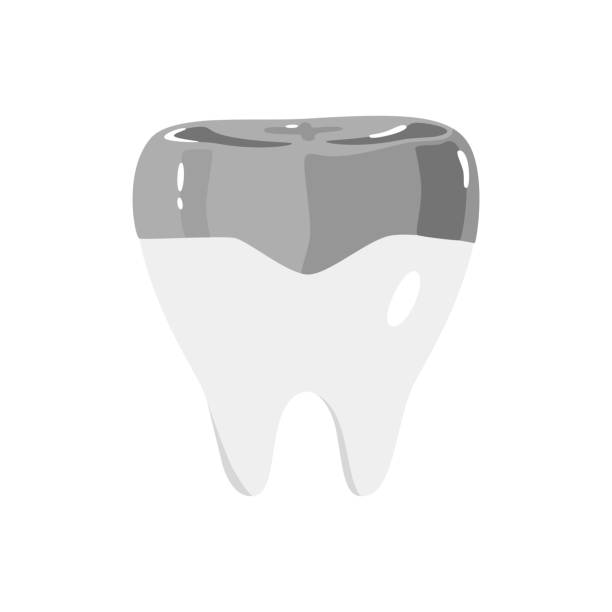 Illustration of teeth. Silver tooth filling. Illustration of teeth. Silver tooth filling. silver teeth stock illustrations