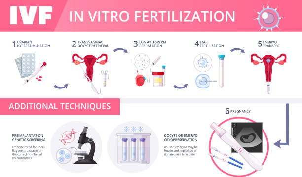 1,515 In Vitro Fertilization Illustrations & Clip Art - iStock