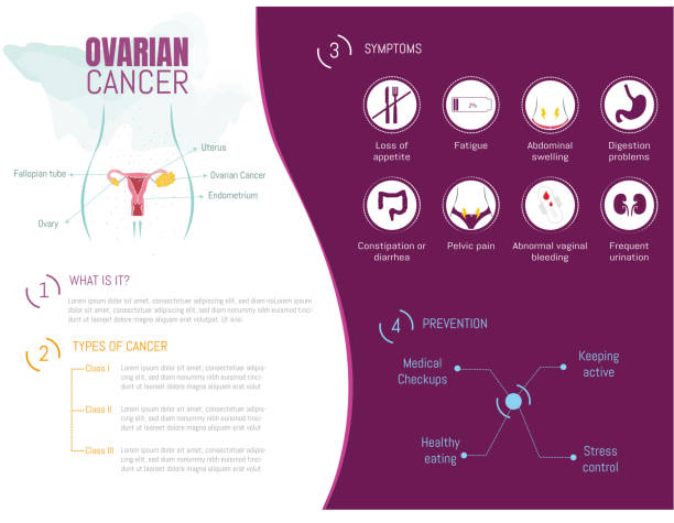 Infographic of ovarian cancer Infographic of ovarian cancer, q, types, symptoms and how to prevent it and its corresponding icons. Pilar Cyst stock illustrations