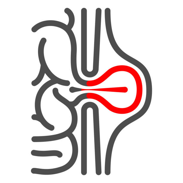 Inguinal hernia line icon, Human diseases concept, hernia sign on white background, Peritonitis icon in outline style for mobile concept and web design. Vector graphics. Inguinal hernia line icon, Human diseases concept, hernia sign on white background, Peritonitis icon in outline style for mobile concept and web design. Vector graphics hernia inguinal stock illustrations