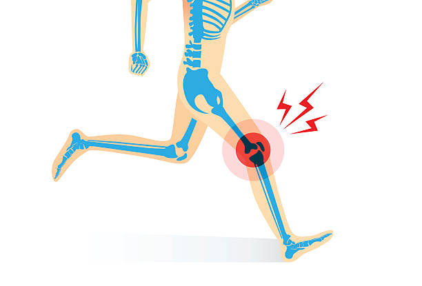 Injury of knee bone and leg while running Injury of knee bone and leg while human running. Illustration about medical and sport. pain silhouettes stock illustrations