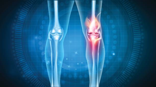 Knee pain abstract design Joint problems bright abstract design, burning damaged knee knee stock illustrations