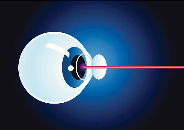 Laser eye surgery vector art illustration