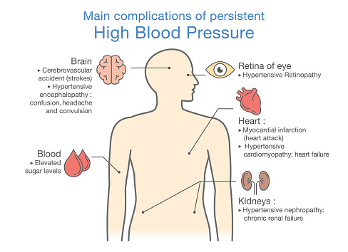 Main complications of persistent High Blood Pressure.