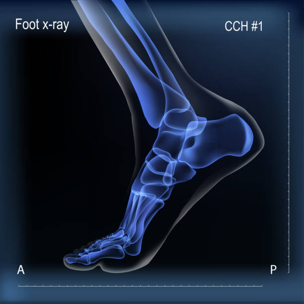Medial view x ray of bones the of foot. Vector realistic dark navy blue x ray of skeleton of foot. Human leg bones. Anatomy of joints. Medial view. For advertising or medical publications. Illustration stock vector. foot anatomy stock illustrations