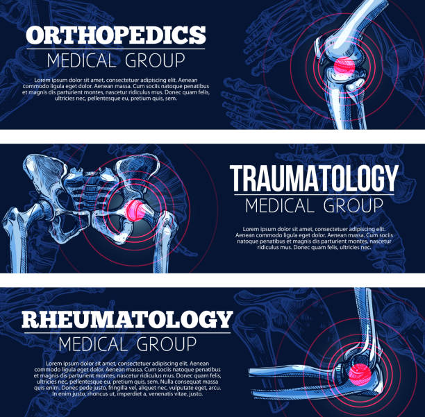 Medical vector banners orhtopedics, traumatology Orthopedics, traumatology and rheumatology medical banners set. Vector design of x-ray bones and joints of human body legs knee or foot, spine and arm hand or wrist and shoulder arthritis and trauma orthopedics stock illustrations