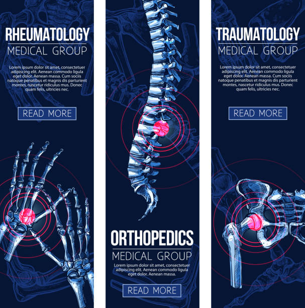 Medical vector banners rheumatology traumatology Rheumatology and orthopedics traumatology medicine banners. Vector set of medical x-ray of human body bones and joints for leg knee or foot, spine and arm hand trauma, and wrist arthritis pain drawings stock illustrations