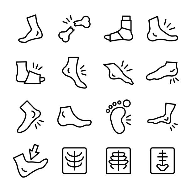 Medical, X Ray Line Vector Icons Set Give your designs the jolt and medicinal pick me up they need with this medical icons. this set composed with foot, fracture, human foot, medical, x ray. plantar fasciitis stock illustrations